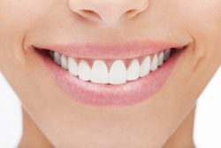 woman with nice smile dental veneers asheville nc