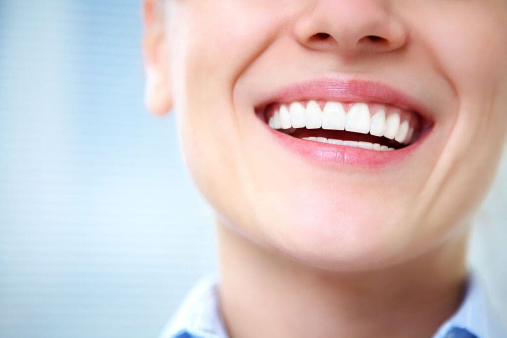 cosmetic tooth bonding treatment in Asheville North Carolina