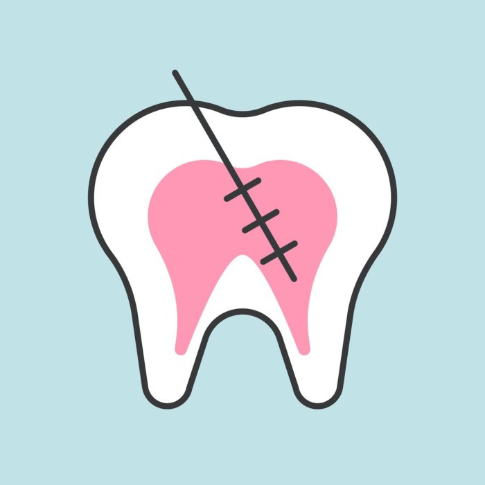 dental injury Asheville North Carolina