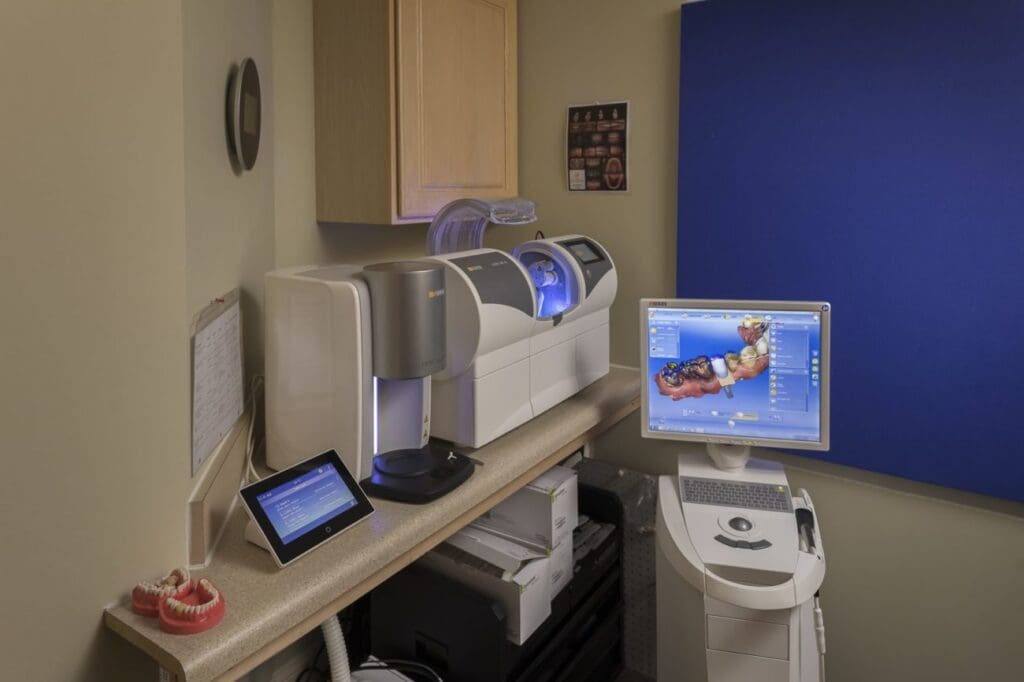 Cerec Asheville NC