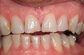 patient_02-before
