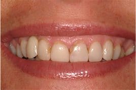 patient_10-before